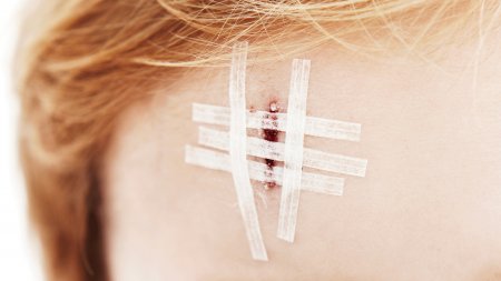 割傷、擦傷、疤痕......加速修復的方法 | 香港BIODERMA | 皮膚醫學專家